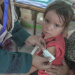 2024 Gaza nutriton child